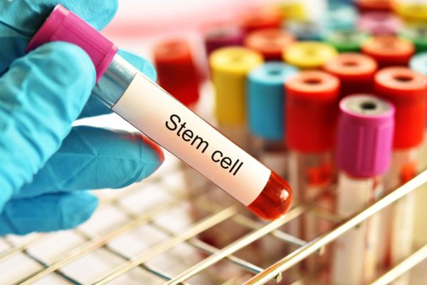 Stem cell